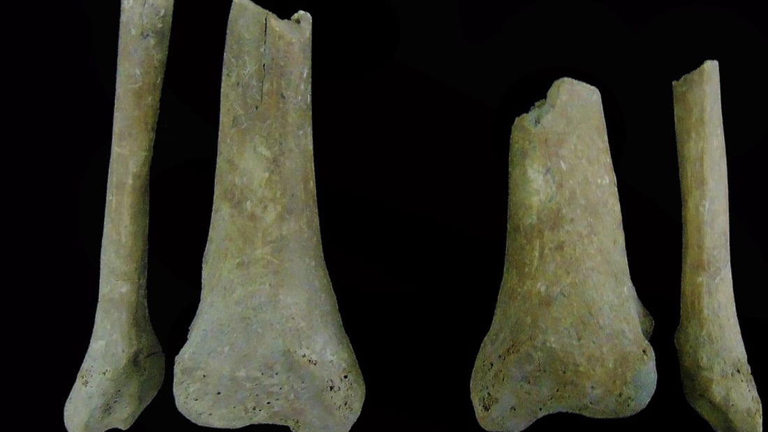 Oblique cuts in the bottom third of the legs of a medie<em></em>val skeleton found in Portugal.